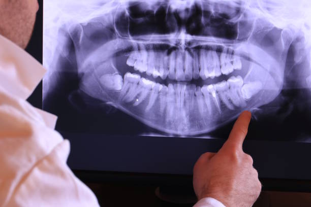 Best Emergency Wisdom Teeth Removal in Drexel Heights, AZ